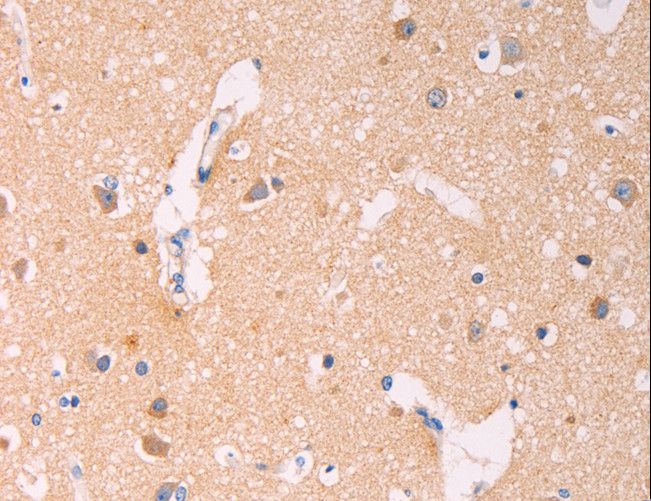 ADCY1 / Adenylate Cyclase 1 Antibody - Immunohistochemistry of paraffin-embedded Human brain using ADCY1 Polyclonal Antibody at dilution of 1:60.