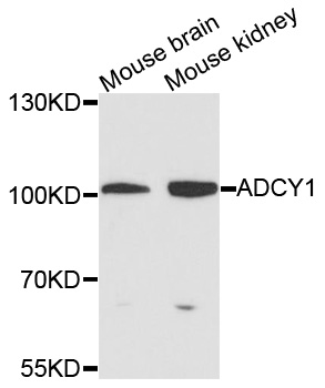 ADCY1 / Adenylate Cyclase 1 Antibody - Western blot analysis of extracts of various cells.