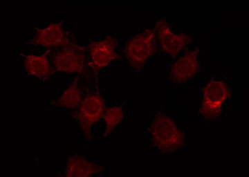 ADCY1 / Adenylate Cyclase 1 Antibody - Staining COLO205 cells by IF/ICC. The samples were fixed with PFA and permeabilized in 0.1% Triton X-100, then blocked in 10% serum for 45 min at 25°C. The primary antibody was diluted at 1:200 and incubated with the sample for 1 hour at 37°C. An Alexa Fluor 594 conjugated goat anti-rabbit IgG (H+L) Ab, diluted at 1/600, was used as the secondary antibody.
