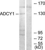 ADCY1 / Adenylate Cyclase 1 Antibody - Western blot analysis of extracts from COLO205 cells, using ADCY1 antibody.