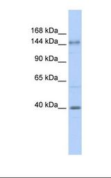 ADCY10 / Adenylate Cyclase 10 Antibody - Fetal brain lysate. Antibody concentration: 1.0 ug/ml. Gel concentration: 6-18%.  This image was taken for the unconjugated form of this product. Other forms have not been tested.