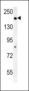 ADCY10 / Adenylate Cyclase 10 Antibody - ADCY10 Antibody western blot of K562 cell line lysates (35 ug/lane). The ADCY10 antibody detected the ADCY10 protein (arrow).