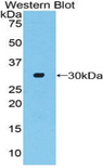 ADCY2 / Adenylate Cyclase 2 Antibody - Western blot of recombinant ADCY2 / Adenylate Cyclase 2.  This image was taken for the unconjugated form of this product. Other forms have not been tested.