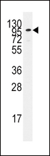 ADCY2 / Adenylate Cyclase 2 Antibody - Western blot of anti-ADCY2 antibody in Jurkat cell line lysates (35 ug/lane). ADCY2(arrow) was detected using the purified antibody.
