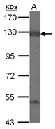 ADCY2 / Adenylate Cyclase 2 Antibody - Sample (30 ug of whole cell lysate) A: IMR32 7.5% SDS PAGE ADCY2 antibody diluted at 1:1000
