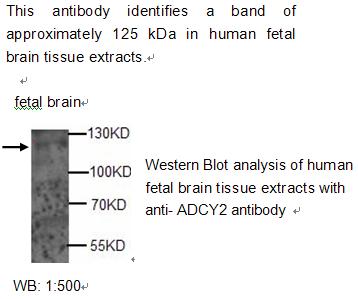 ADCY2 / Adenylate Cyclase 2 Antibody