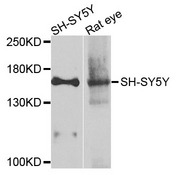 ADCY2 / Adenylate Cyclase 2 Antibody - Western blot analysis of extracts of various cells.