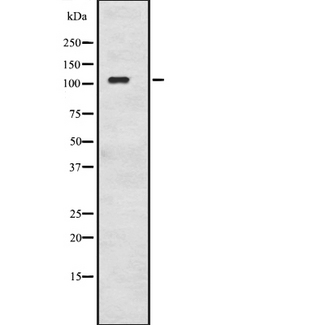 ADCY2 / Adenylate Cyclase 2 Antibody - Western blot analysis of ADCY2 expression in Jurkat cells lysate. The lane on the left is treated with the antigen-specific peptide.