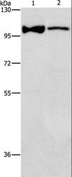 ADCY3 / Adenylate Cyclase 3 Antibody - Western blot analysis of Lovo cell and human fetal brain tissue, using ADCY3 Polyclonal Antibody at dilution of 1:312.5.