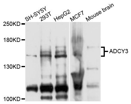 ADCY3 / Adenylate Cyclase 3 Antibody - Western blot analysis of extracts of various cells.