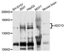 ADCY3 / Adenylate Cyclase 3 Antibody - Western blot analysis of extracts of various cells.