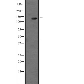 ADCY3 / Adenylate Cyclase 3 Antibody - Western blot analysis of ADCY3 expression in rat olfactory epithelium lysate; rat frontal cortex lysate. The lane on the left is treated with the antigen-specific peptide.