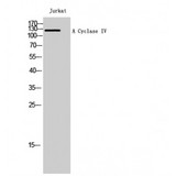 ADCY4 / Adenylate Cyclase 4 Antibody - Western blot of A Cyclase IV antibody