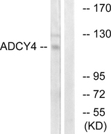 ADCY4 / Adenylate Cyclase 4 Antibody - Western blot analysis of lysates from Jurkat cells, using ADCY4 Antibody. The lane on the right is blocked with the synthesized peptide.