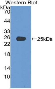 ADCY4 / Adenylate Cyclase 4 Antibody - Western blot of recombinant ADCY4 / Adenylate Cyclase 4.