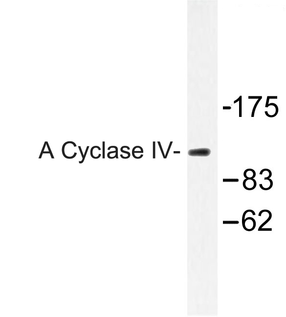 ADCY4 / Adenylate Cyclase 4 Antibody - Western blot of A Cyclase IV (L226) pAb in extracts from Jurkat cells.