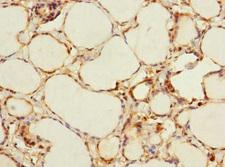 ADCY4 / Adenylate Cyclase 4 Antibody - Immunohistochemistry of paraffin-embedded human thyroid tissue at dilution 1:100
