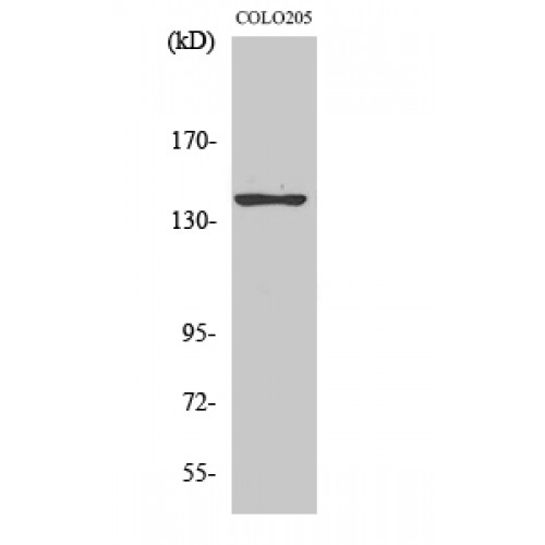 ADCY5+6 Antibody - Western blot of A Cyclase V/VI antibody
