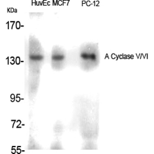 ADCY5+6 Antibody - Western blot of A Cyclase V/VI antibody