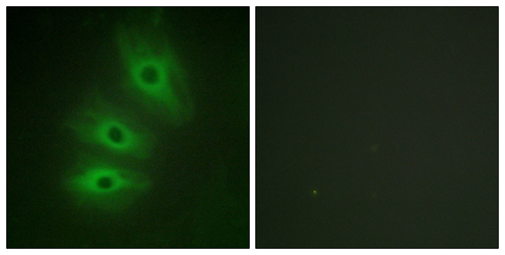 ADCY5+6 Antibody - Immunofluorescence analysis of HeLa cells, using ADCY5/6 Antibody. The picture on the right is blocked with the synthesized peptide.