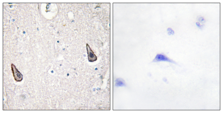 ADCY5+6 Antibody - Immunohistochemistry analysis of paraffin-embedded human brain tissue, using ADCY5/6 Antibody. The picture on the right is blocked with the synthesized peptide.
