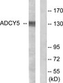 ADCY5+6 Antibody - Western blot analysis of lysates from COLO205 cells, using ADCY5/6 Antibody. The lane on the right is blocked with the synthesized peptide.