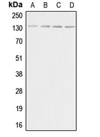 ADCY5+6 Antibody - Western blot analysis of Adenylate Cyclase 5/6 expression in HeLa (A); Raw264.7 (B); PC12 (C); rat brain (D) whole cell lysates.