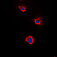 ADCY5+6 Antibody - Immunofluorescent analysis of Adenylate Cyclase 5/6 staining in Raw264.7 cells. Formalin-fixed cells were permeabilized with 0.1% Triton X-100 in TBS for 5-10 minutes and blocked with 3% BSA-PBS for 30 minutes at room temperature. Cells were probed with the primary antibody in 3% BSA-PBS and incubated overnight at 4 C in a humidified chamber. Cells were washed with PBST and incubated with a DyLight 594-conjugated secondary antibody (red) in PBS at room temperature in the dark. DAPI was used to stain the cell nuclei (blue).