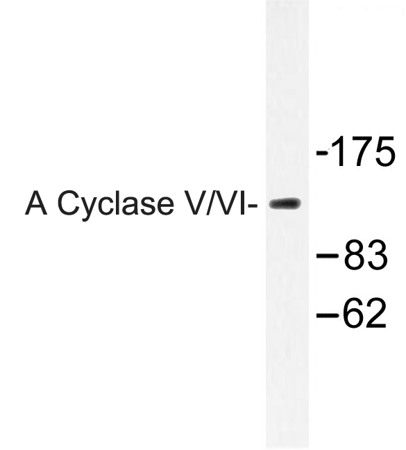 ADCY5+6 Antibody - Western blot of A Cyclase V/VI (F1052) pAb in extracts from COLO205 cells.
