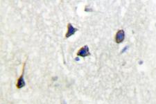 ADCY5+6 Antibody - IHC of Cyclase V/VI (F1052) pAb in paraffin-embedded human brain tissue.