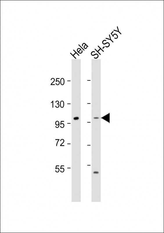 ADCY5 / Adenylate Cyclase 5 Antibody - All lanes: Anti-ADCY5 Antibody (Center) at 1:1000-1:2000 dilution. Lane 1: HeLa whole cell lysate. Lane 2: SH-SY5Y whole cell lysate Lysates/proteins at 20 ug per lane. Secondary Goat Anti-Rabbit IgG, (H+L), Peroxidase conjugated at 1:10000 dilution. Predicted band size: 139 kDa. Blocking/Dilution buffer: 5% NFDM/TBST.