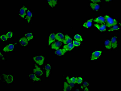 ADCY5 / Adenylate Cyclase 5 Antibody - Immunofluorescence staining of Hela cells diluted at 1:33, counter-stained with DAPI. The cells were fixed in 4% formaldehyde, permeabilized using 0.2% Triton X-100 and blocked in 10% normal Goat Serum. The cells were then incubated with the antibody overnight at 4°C.The Secondary antibody was Alexa Fluor 488-congugated AffiniPure Goat Anti-Rabbit IgG (H+L).