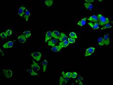 ADCY5 / Adenylate Cyclase 5 Antibody - Immunofluorescence staining of Hela cells diluted at 1:33, counter-stained with DAPI. The cells were fixed in 4% formaldehyde, permeabilized using 0.2% Triton X-100 and blocked in 10% normal Goat Serum. The cells were then incubated with the antibody overnight at 4°C.The Secondary antibody was Alexa Fluor 488-congugated AffiniPure Goat Anti-Rabbit IgG (H+L).