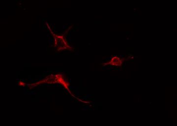 ADCY5 / Adenylate Cyclase 5 Antibody - Staining COLO205 cells by IF/ICC. The samples were fixed with PFA and permeabilized in 0.1% Triton X-100, then blocked in 10% serum for 45 min at 25°C. The primary antibody was diluted at 1:200 and incubated with the sample for 1 hour at 37°C. An Alexa Fluor 594 conjugated goat anti-rabbit IgG (H+L) antibody, diluted at 1/600, was used as secondary antibody.