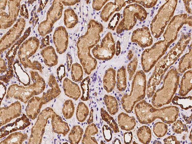 ADCY5 / Adenylate Cyclase 5 Antibody - Immunochemical staining of human ADCY5 in human kidney with rabbit polyclonal antibody at 1:100 dilution, formalin-fixed paraffin embedded sections.