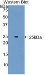 ADCY6 / Adenylate Cyclase 6 Antibody - Western blot of recombinant ADCY6 / Adenylate Cyclase 6.