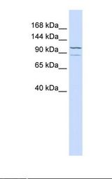 ADCY6 / Adenylate Cyclase 6 Antibody - Hela cell lysate. Antibody concentration: 1.0 ug/ml. Gel concentration: 12%.  This image was taken for the unconjugated form of this product. Other forms have not been tested.