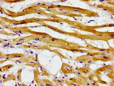 ADCY6 / Adenylate Cyclase 6 Antibody - Immunohistochemistry image of paraffin-embedded human heart tissue at a dilution of 1:100