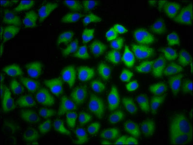 ADCY6 / Adenylate Cyclase 6 Antibody - Immunofluorescence staining of Hela cells with ADCY6 Antibody at 1:133, counter-stained with DAPI. The cells were fixed in 4% formaldehyde, permeabilized using 0.2% Triton X-100 and blocked in 10% normal Goat Serum. The cells were then incubated with the antibody overnight at 4°C. The secondary antibody was Alexa Fluor 488-congugated AffiniPure Goat Anti-Rabbit IgG(H+L).