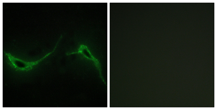 ADCY7 / Adenylate Cyclase 7 Antibody - Immunofluorescence analysis of NIH/3T3 cells, using ADCY7 Antibody. The picture on the right is blocked with the synthesized peptide.
