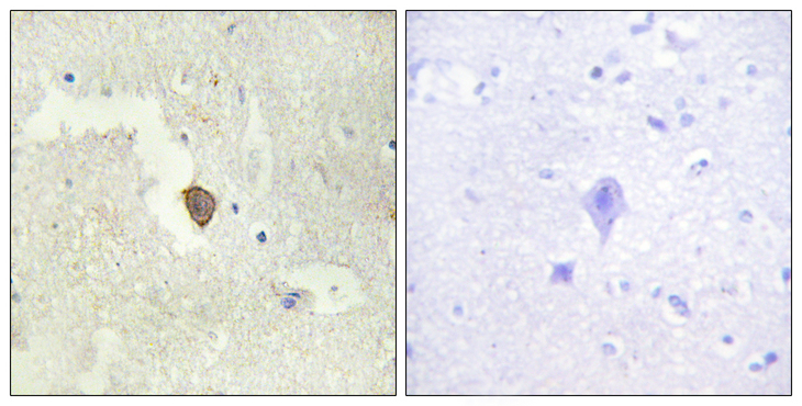 ADCY7 / Adenylate Cyclase 7 Antibody - Immunohistochemistry analysis of paraffin-embedded human brain tissue, using ADCY7 Antibody. The picture on the right is blocked with the synthesized peptide.