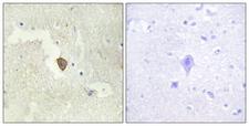 ADCY7 / Adenylate Cyclase 7 Antibody - Immunohistochemistry analysis of paraffin-embedded human brain tissue, using ADCY7 Antibody. The picture on the right is blocked with the synthesized peptide.