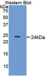 ADCY7 / Adenylate Cyclase 7 Antibody - Western blot of ADCY7 / Adenylate Cyclase 7 antibody.