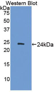 ADCY7 / Adenylate Cyclase 7 Antibody - Western blot of ADCY7 / Adenylate Cyclase 7 antibody.