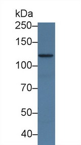 ADCY7 / Adenylate Cyclase 7 Antibody - Western Blot; Sample: Human MCF7 cell lysate; Primary Ab: 3µg/ml Rabbit Anti-Mouse ADCY7 Antibody Second Ab: 0.2µg/mL HRP-Linked Caprine Anti-Rabbit IgG Polyclonal Antibody