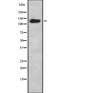 ADCY7 / Adenylate Cyclase 7 Antibody - Western blot analysis of ADCY7 using Jurkat whole cells lysates