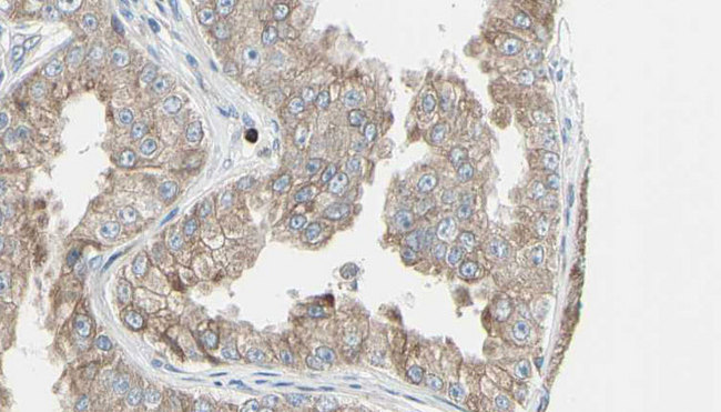 ADCY7 / Adenylate Cyclase 7 Antibody - 1:100 staining human prostate tissue by IHC-P. The sample was formaldehyde fixed and a heat mediated antigen retrieval step in citrate buffer was performed. The sample was then blocked and incubated with the antibody for 1.5 hours at 22°C. An HRP conjugated goat anti-rabbit antibody was used as the secondary.
