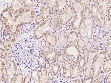 ADCY7 / Adenylate Cyclase 7 Antibody - Immunochemical staining of human ADCY7 in human kidney with rabbit polyclonal antibody at 1:100 dilution, formalin-fixed paraffin embedded sections.