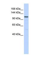 ADCY8 / Adenylate Cyclase 8 Antibody - ADCY8 antibody Western blot of 721_B cell lysate. This image was taken for the unconjugated form of this product. Other forms have not been tested.