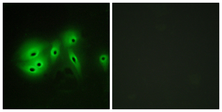 ADCY8 / Adenylate Cyclase 8 Antibody - Immunofluorescence analysis of A549 cells, using ADCY8 Antibody. The picture on the right is blocked with the synthesized peptide.